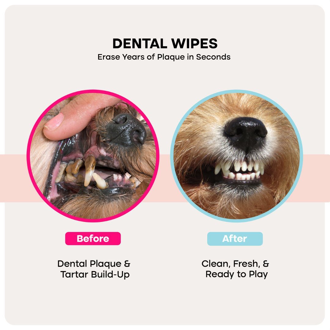 PureCare™ Kit